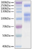 Recombinant SARS-CoV-2 Spike S1+S2 ECD(S-ECD)(D614G)  Protein (RPCB0924)