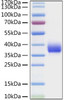 Recombinant SARS-CoV Spike RBD  Protein (RPCB0925)