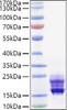 Recombinant Mouse IL-17A/CTLA-8 Protein (RPCB0932)