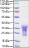 Recombinant Human B29/CD79B Protein (RPCB0933)