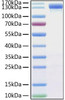 Recombinant MERS-CoV Spike S1 Protein (RPCB0937)