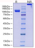 Recombinant Human Endoglin/ENG/CD105 Protein (RPCB0945)