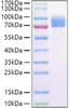 Recombinant Cynomolgus IL-2RG/CD132 Protein (RPCB0950)