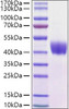 Recombinant Mouse Mesothelin/MSLN Protein (RPCB0953)