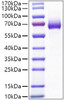 Recombinant Mouse IL-2RA/CD25 Protein (RPCB0968)