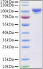 Recombinant Human Prolyl endopeptidase FAP Protein (RPCB0971)