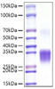 Recombinant Mouse CD8a Protein (RPCB0977)