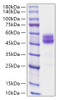 Recombinant Mouse TIGIT Protein (RPCB0981)