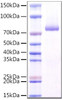 Recombinant Human CLEC7A/Dectin-1/CD369 Protein (RPCB0982)