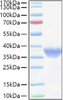 Recombinant Human FR-alpha/FOLR1 Protein (RPCB0984)