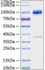Recombinant Mouse TNFRSF11B/Osteoprotegerin Protein (RPCB0986)