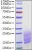 Recombinant Human Fibronectin/CIG/FN1 Protein (RPCB0990)