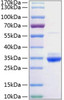 Recombinant Rat C-Reactive Protein/CRP Protein (RPCB0996)