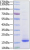 Recombinant Human CD3 epsilon Protein (RPCB0998)