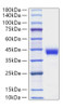 Recombinant Human Zinc-alpha-2-glycoprotein/AZGP1 Protein (RPCB1005)