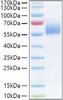Recombinant Human IL-36R/IL-1Rrp2/IL1RL2 Protein (RPCB1011)