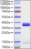 Recombinant Human Apolipoprotein E/ApoE Protein (RPCB1024)