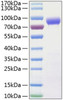 Recombinant Human IL-15RA/CD215 Protein (RPCB1029)