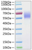 Recombinant Human IL-13RA1/CD213a1 Protein (RPCB1036)