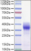 Recombinant Mouse Basigin/EMMPRIN/CD147 Protein (RPCB1041)
