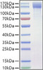 Recombinant Mouse OSMR/IL-31RB Protein (RPCB1042)