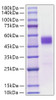 Recombinant Mouse TIGIT Protein (RPCB1049)