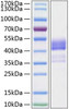 Recombinant Human TNFRSF13C/BAFFR/CD268 Protein (RPCB1056)