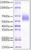 Recombinant Mouse IL1RL1/ST2 Protein (RPCB1063)