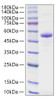 Recombinant Human TNFSF13/APRIL/CD256 Protein (RPCB1083)