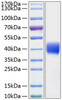 Recombinant Human Mesothelin/MSLN Protein (RPCB1084)