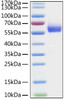 Recombinant HCoV-OC43 Hemagglutinin esterase/HE Protein (RPCB1086)