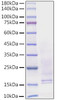 Recombinant Human Beta-nerve growth factor/NGFB Protein (RPCB1092)
