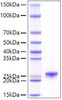 Recombinant Mouse Prolactin/PRL Protein (RPCB1094)