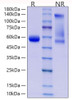 Recombinant Human CD8a Protein (RPCB1095)