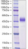 Recombinant Mouse ALK-4/ACVR1B Protein (RPCB1100)