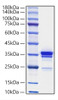 Recombinant Mouse HMGB1 Protein (RPCB1103)
