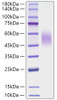 Recombinant Mouse CD200R1 Protein (RPCB1104)
