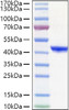 Recombinant Human YKL-40/CHI3L1 Protein (RPCB1114)