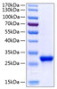 Recombinant Human Tetranectin/CLEC3B Protein (RPCB1120)