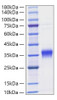 Recombinant Mouse IFN-beta Protein (RPCB1123)