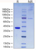 Recombinant Mouse RETN Protein (RPCB1124)