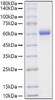 Recombinant Mouse Asparaginyl endopeptidase/Legumain/LGMN Protein (RPCB1130)