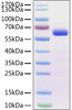 Recombinant Mouse Siglec-15/CD33L3 Protein (RPCB1135)