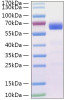 Recombinant SARS-CoV Spike RBD  Protein (RPCB1139)