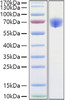 Recombinant Mouse TNFRSF1B/TNF-R2/CD120b Protein (RPCB1152)