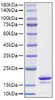 Recombinant Human Alpha-synuclein/SNCA Protein (RPCB1155)