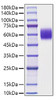 Recombinant Mouse Apolipoprotein H/ApoH Protein (RPCB1156)