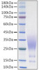 Recombinant Human CX3CL1/Fractalkine Protein (RPCB1159)