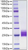 Recombinant human IL-25/IL-17E Protein (RPCB1160)