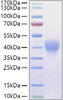 Recombinant Mouse Leukemia inhibitory factor/LIF Protein (RPCB1165)